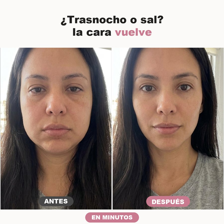 Antes despues trasnocho
