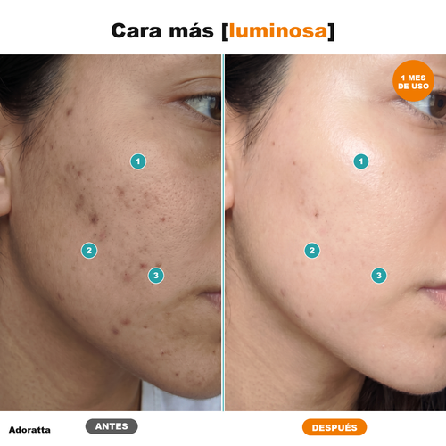 Antes despues cara