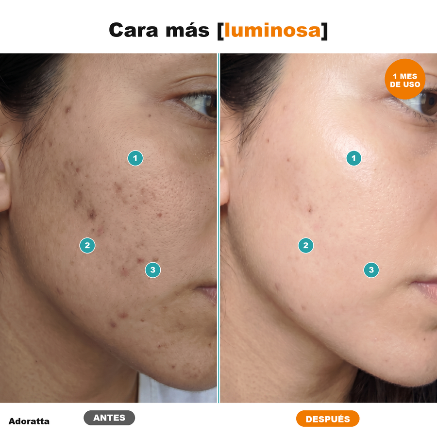 Antes despues cara