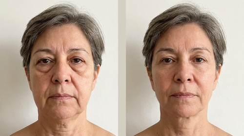 Diana M., 54