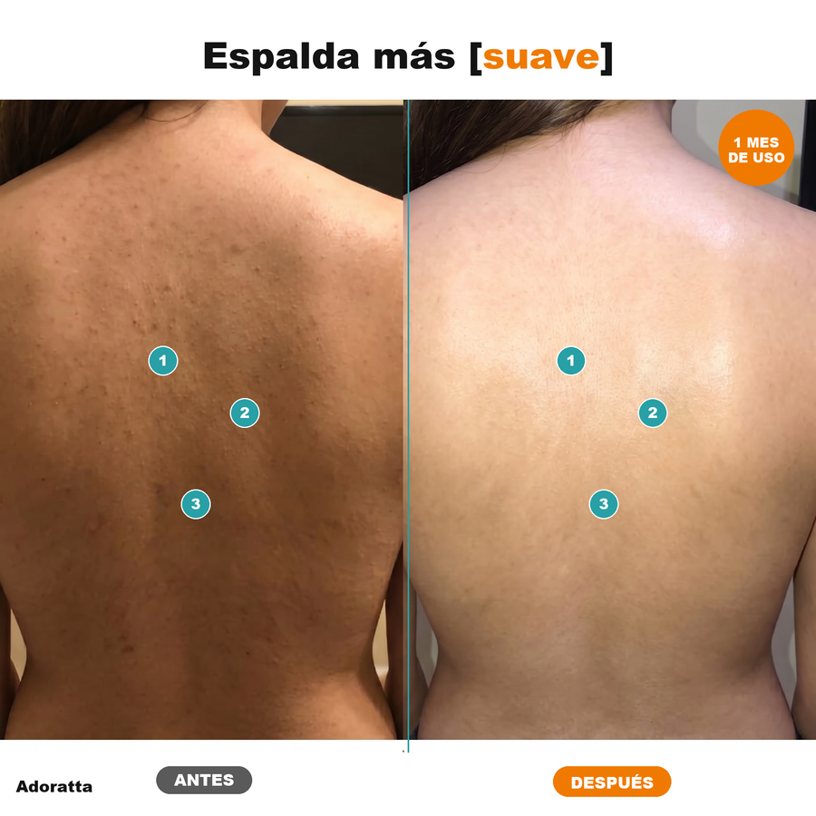 Antes despues espalda