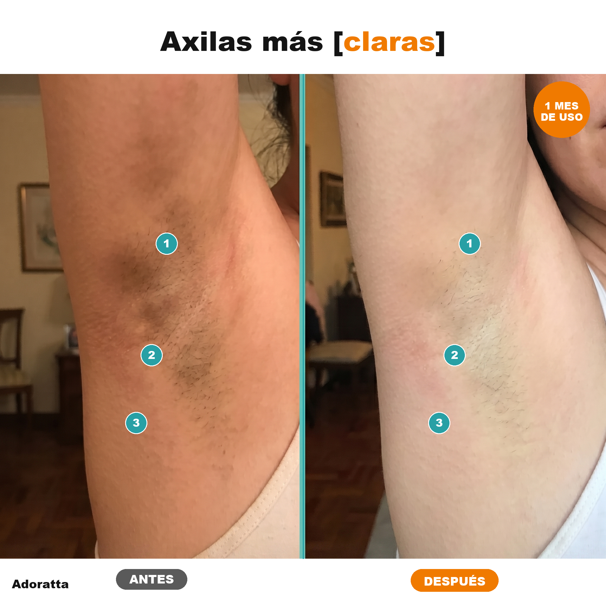 Antes despues axilas