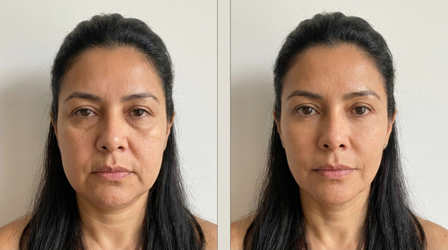 Paula T., 48