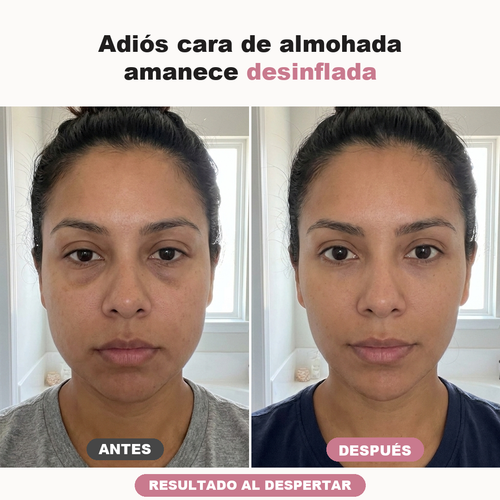 Antes despues matutino