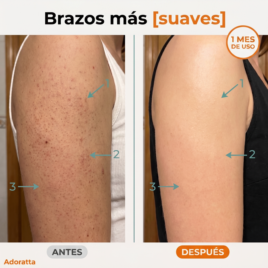 Antes despues brazos