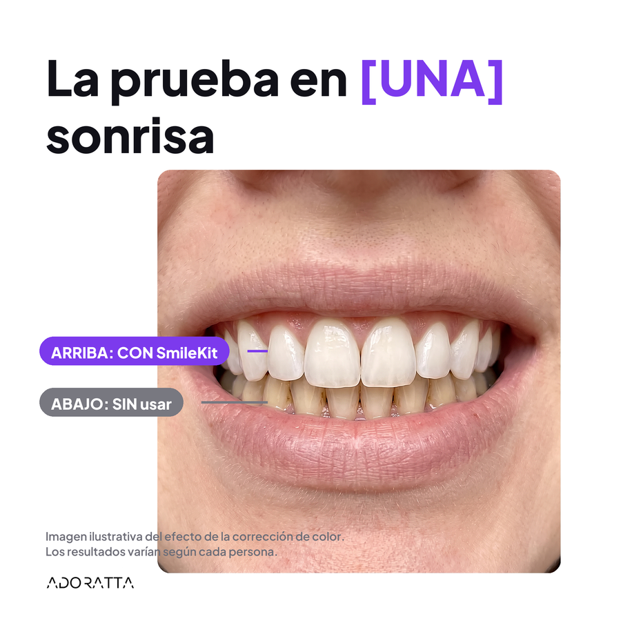 SmileKit antes despues 1